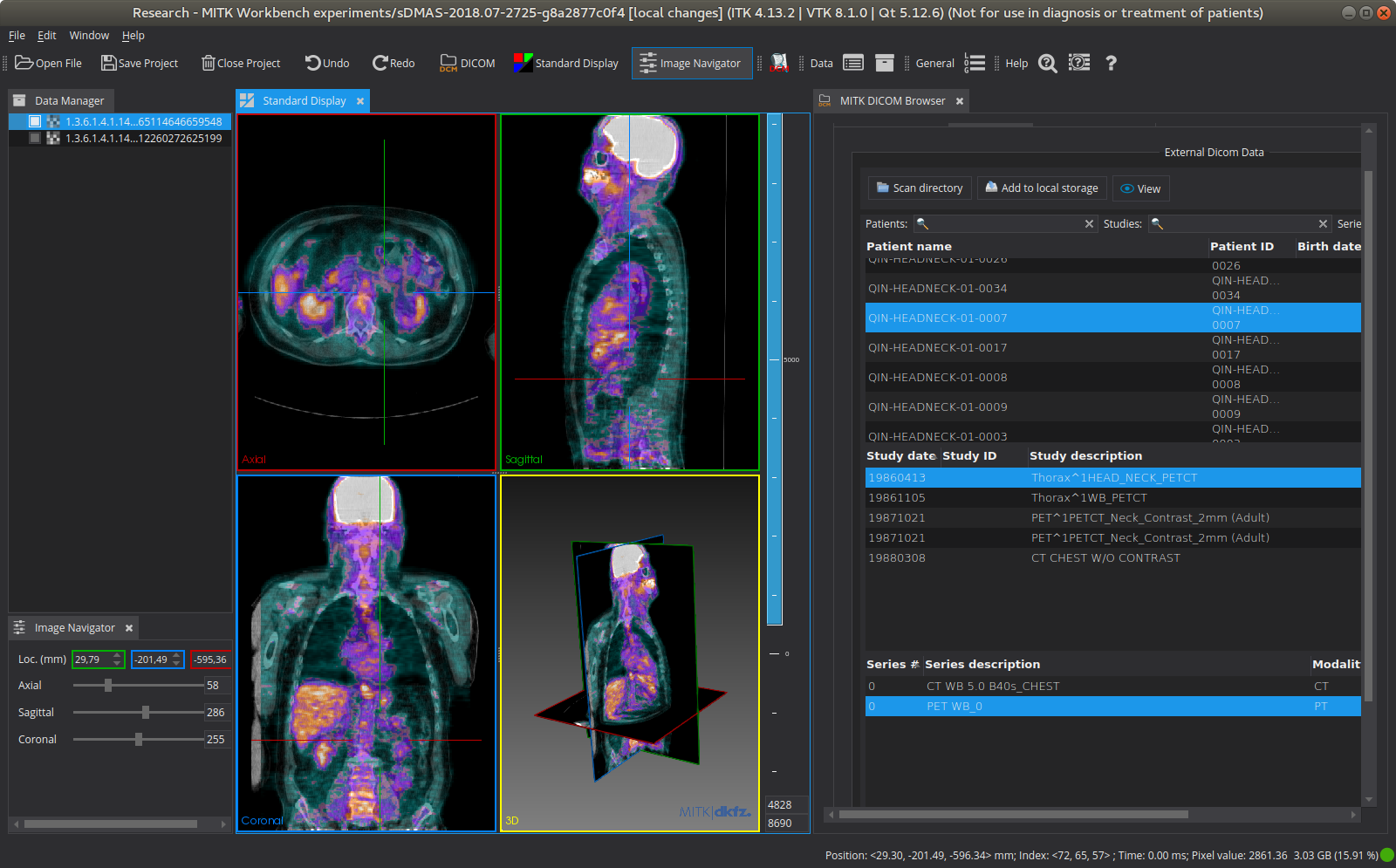 MITK Workbench showing the updated CTK DICOM Browser