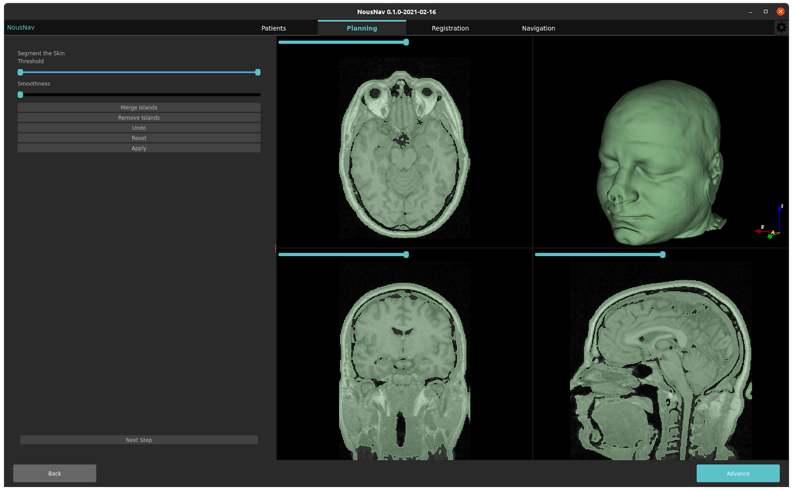 Segmentation interface